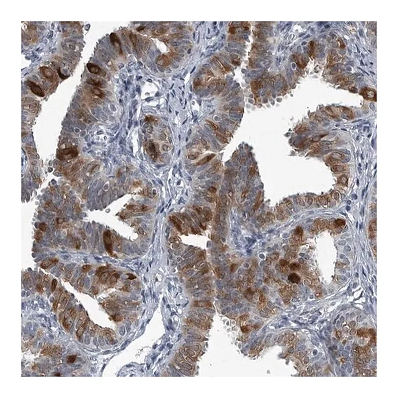 Merck Anti-LRRC6 antibody produced in rabbit