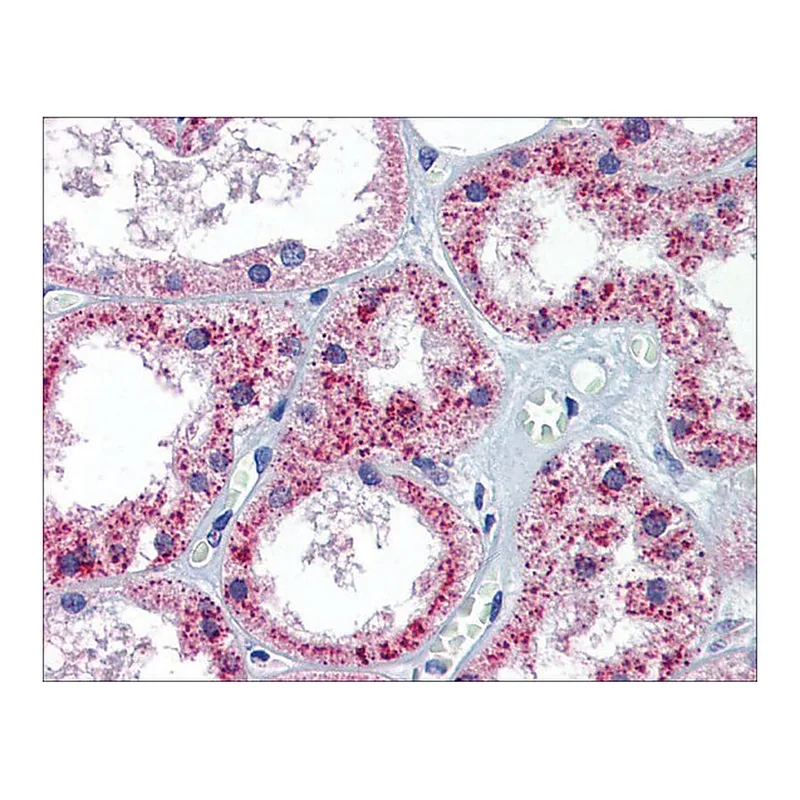 Merck Anti-PTCH1 antibody produced in rabbit