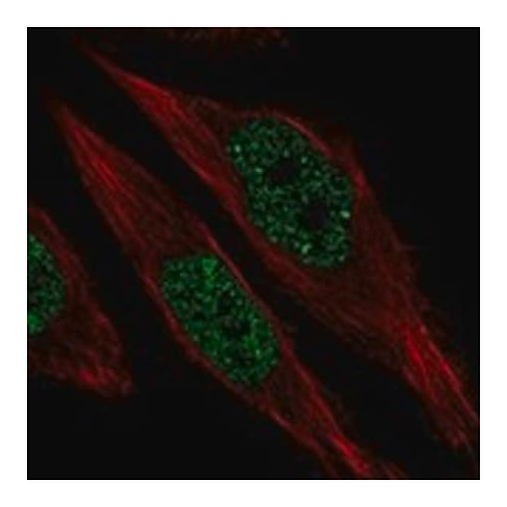 Merck Anti-RFX1 antibody produced in rabbit