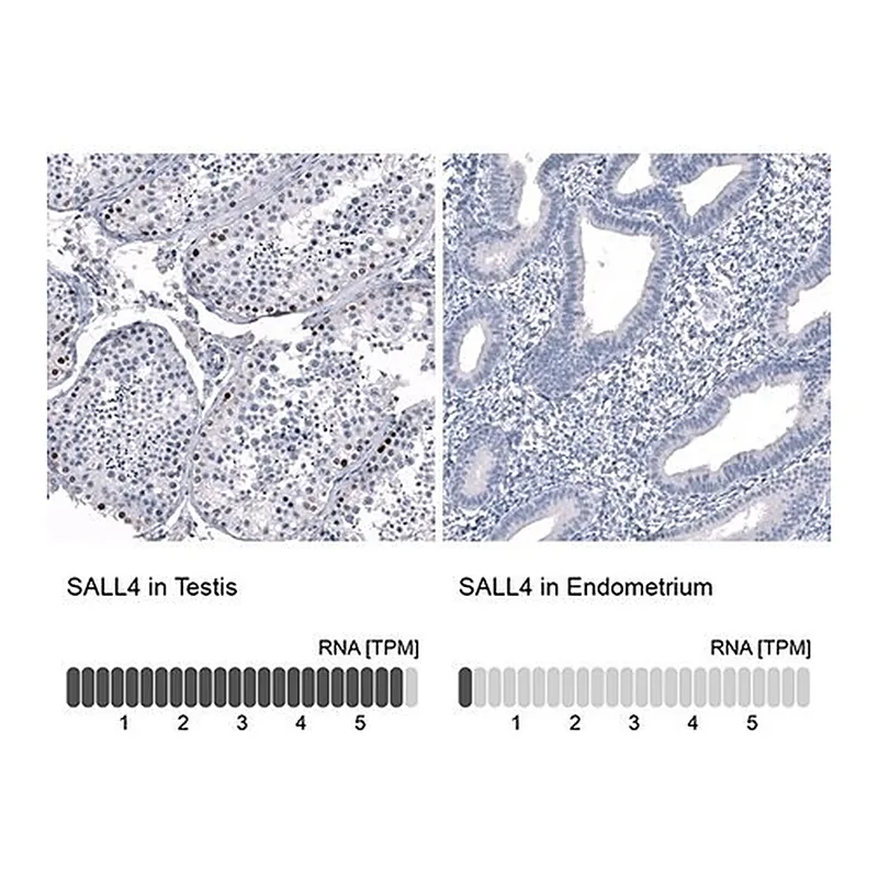 Merck Monoclonal Anti-SALL4 antibody produced in mouse