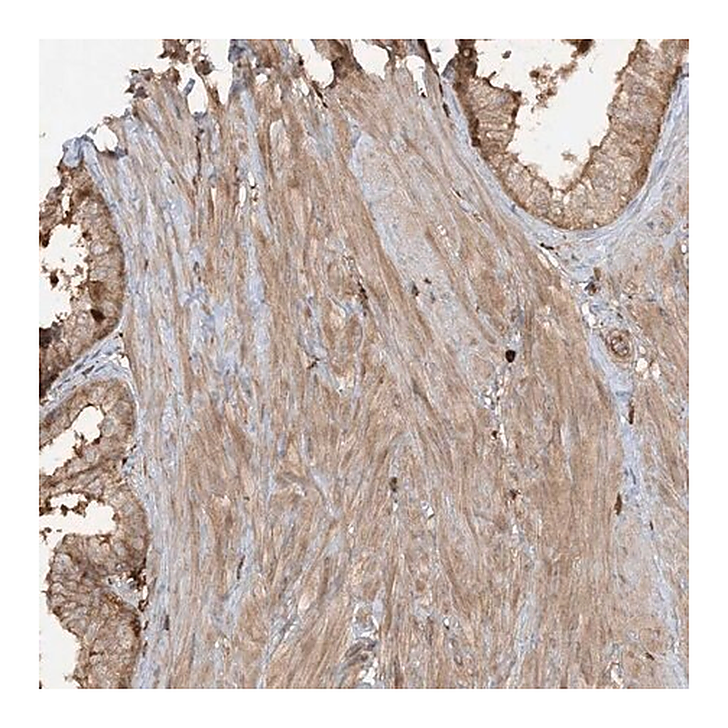 Merck Anti-CAPZB antibody produced in rabbit
