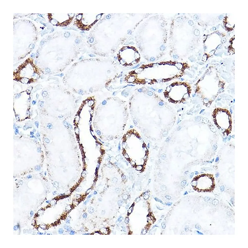 Merck Anti- HK1 antibody produced in rabbit