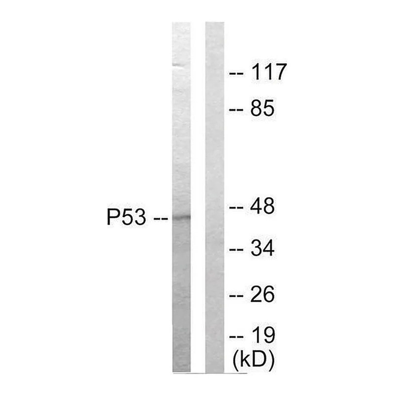 Merck Anti-p53 antibody produced in rabbit