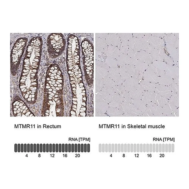 Merck Anti-MTMR11 antibody produced in rabbit