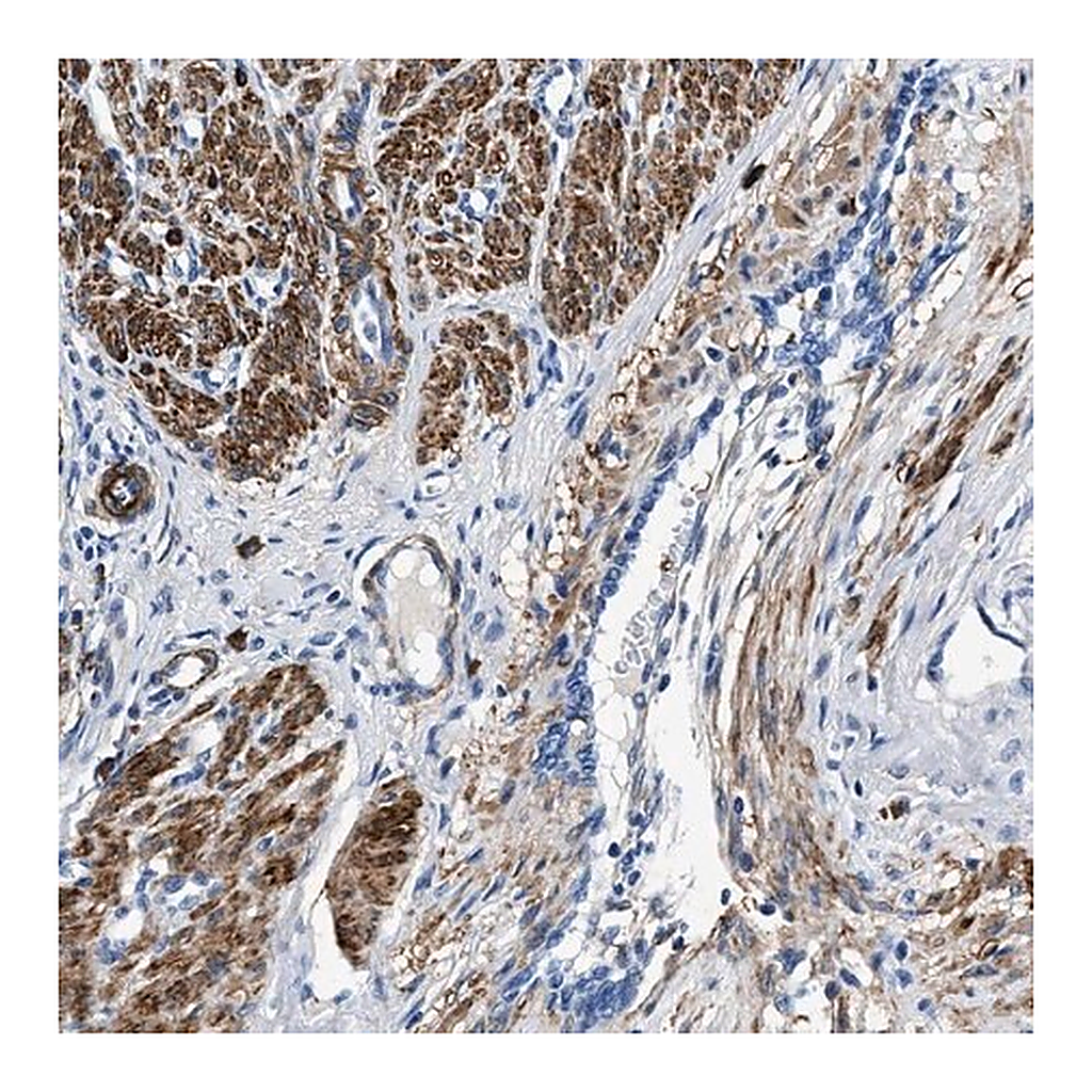 Merck Anti-TEX261 antibody produced in rabbit