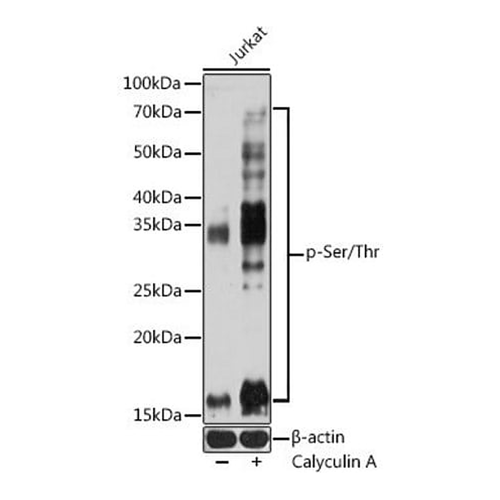 Merck Anti-pan Phospho-Serine/Threonine antibody produced in mouse