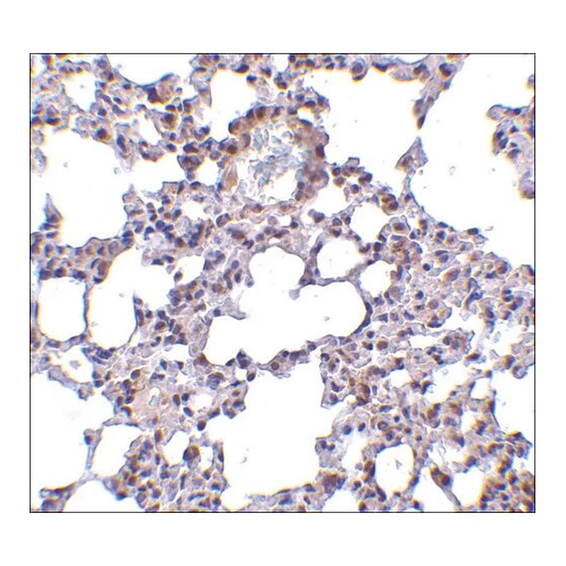 Merck Anti-TRPC6 (ab2) antibody produced in rabbit