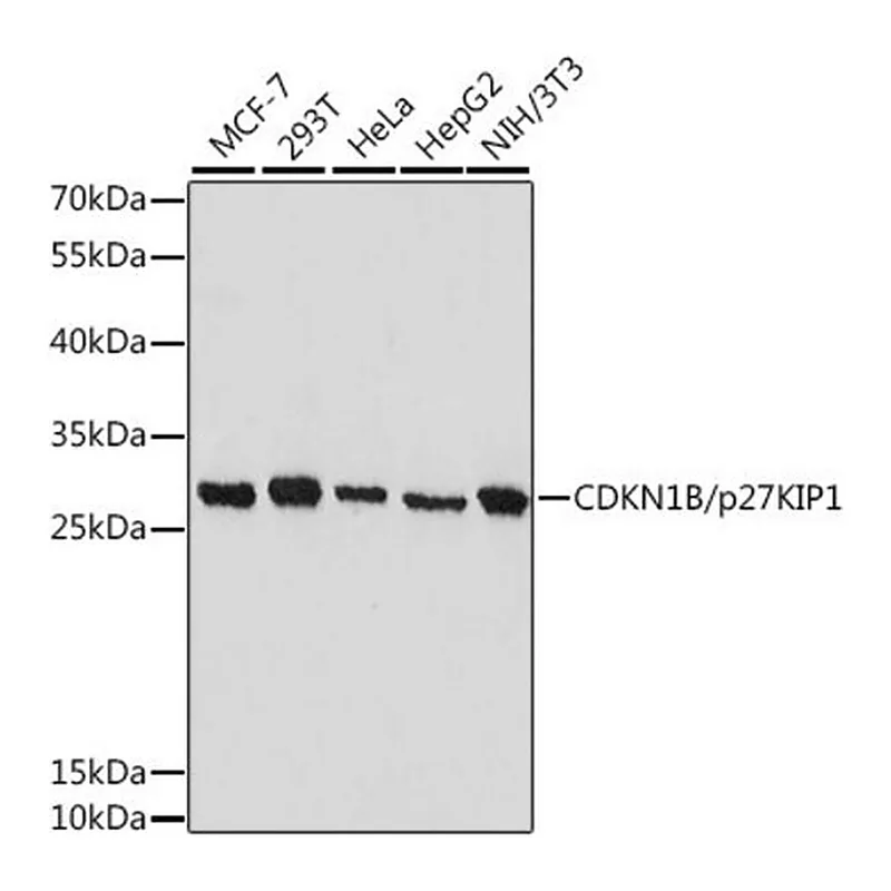 Merck Anti- CDKN1B/p27KIP1 antibody produced in rabbit