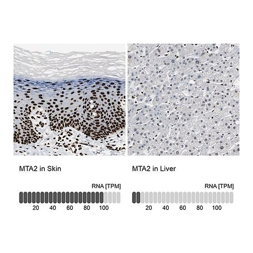 Merck Anti-MTA2 antibody produced in rabbit