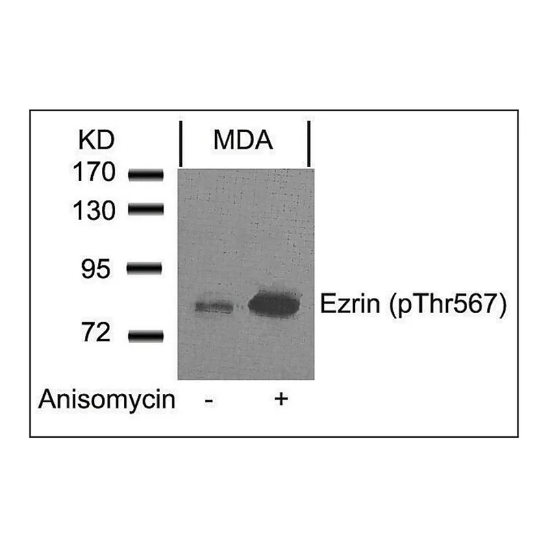 Merck Anti-phospho-EZR (pThr567) antibody produced in rabbit