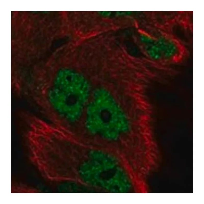 Merck Anti-ID4 antibody produced in rabbit