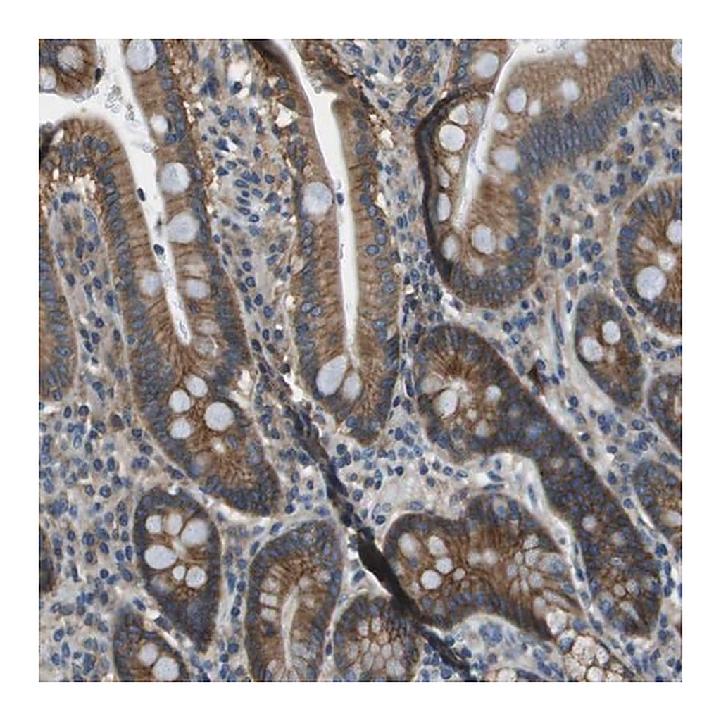 Merck Anti-TMEM51 antibody produced in rabbit