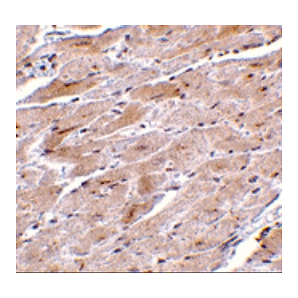 Merck Anti-TRPC3 antibody produced in rabbit
