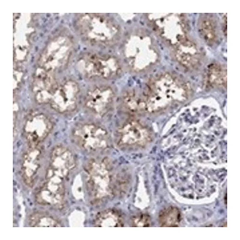 Merck Anti-SLC34A1 antibody produced in rabbit