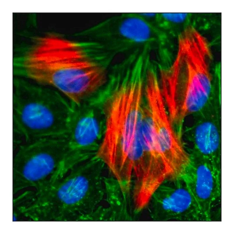 Merck Anti-Calponin-1 antibody, Rabbit monoclonal