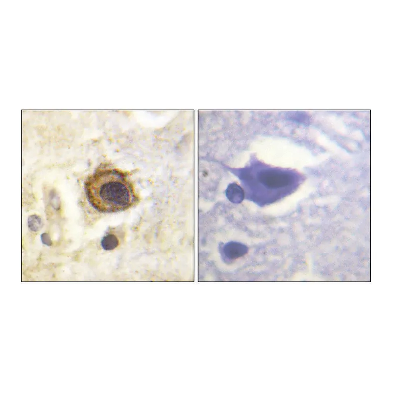 Merck Anti-PDGFR beta antibody produced in rabbit