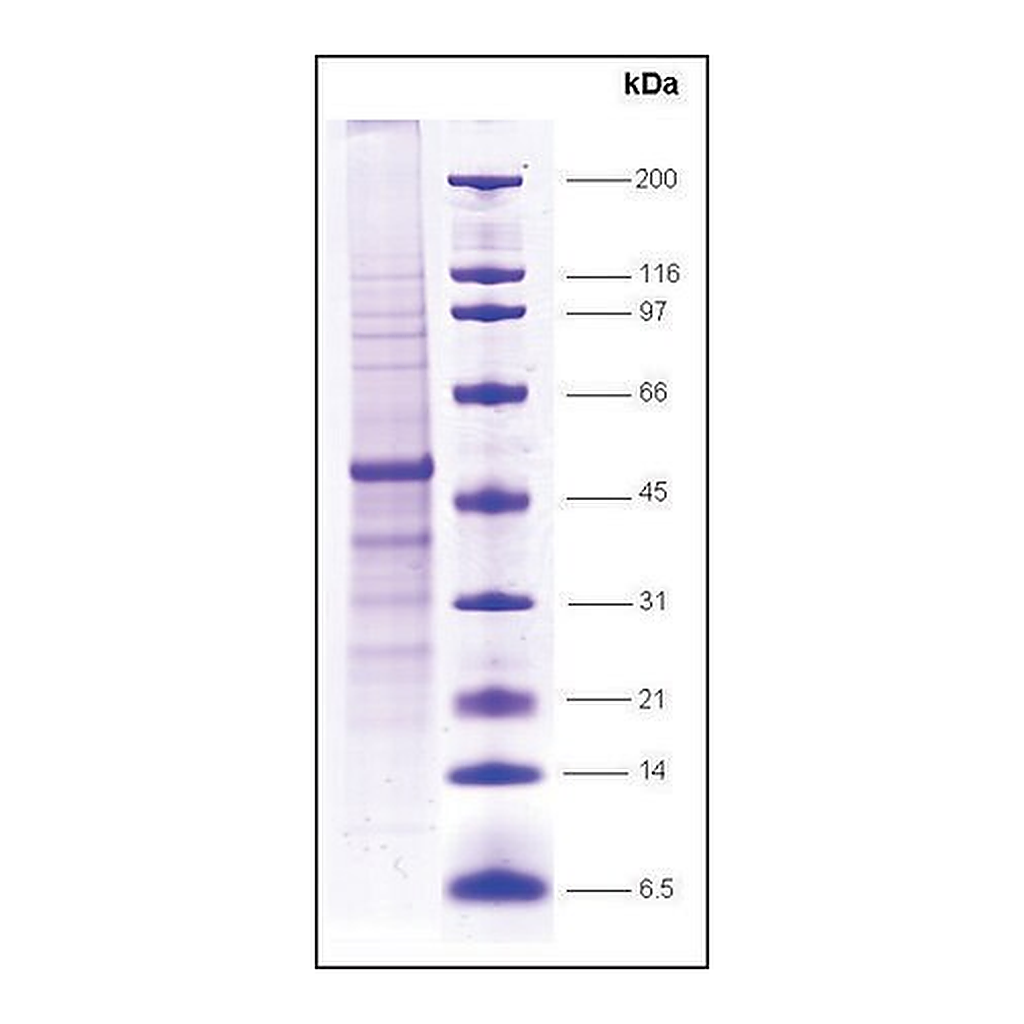 Merck HDAC3 human