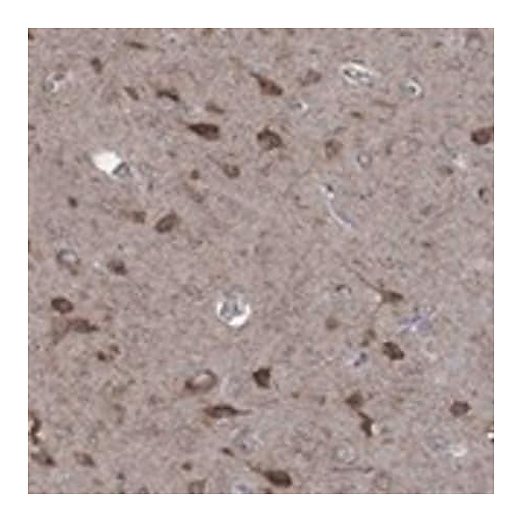 Merck Anti-NCEH1 antibody produced in rabbit
