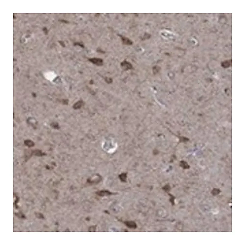 Merck Anti-NCEH1 antibody produced in rabbit