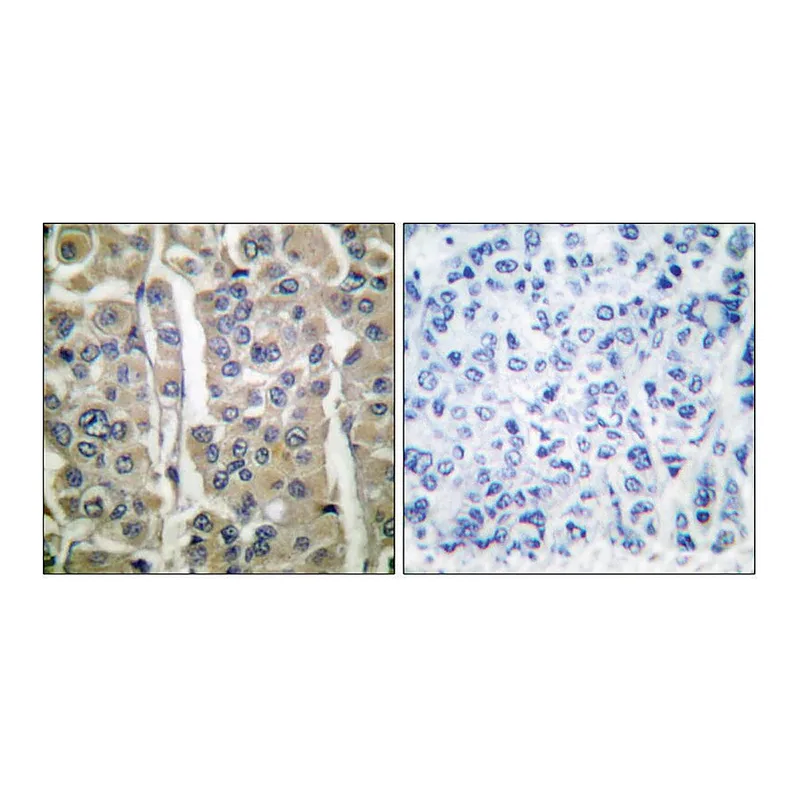 Merck Anti-Involucrin antibody produced in rabbit