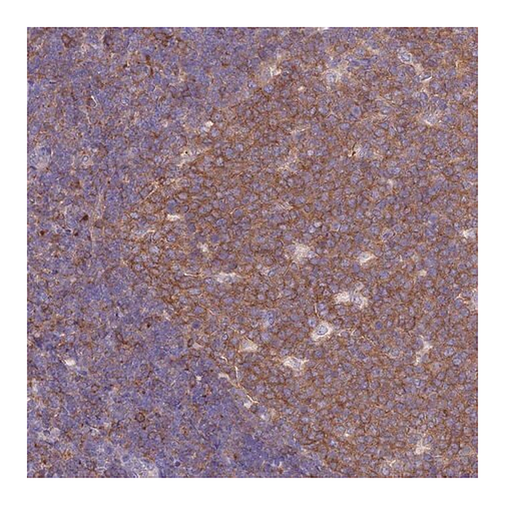 Merck Anti-NAMPT antibody produced in rabbit