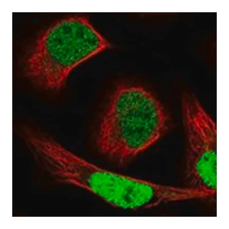 Merck Anti-NCAPG2 antibody produced in rabbit