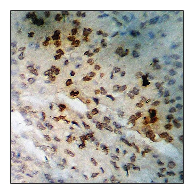 Merck Anti-phospho-BTK (pTyr223) antibody produced in rabbit
