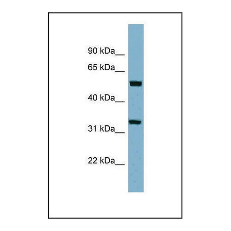Merck Anti-TMEM158 antibody produced in rabbit