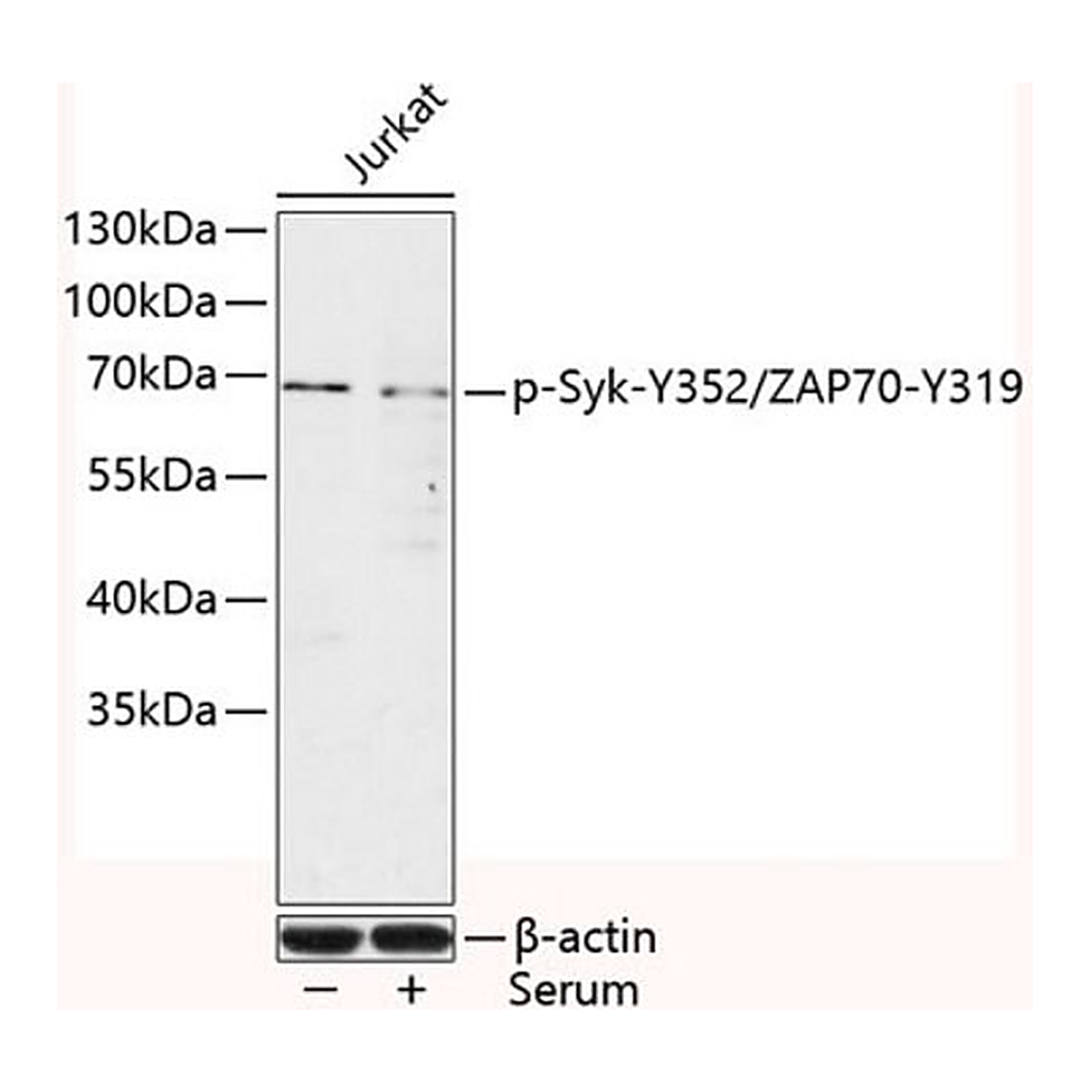 Merck Anti-Phospho-Syk-Y352/ZAP70-Y319 antibody produced in rabbit