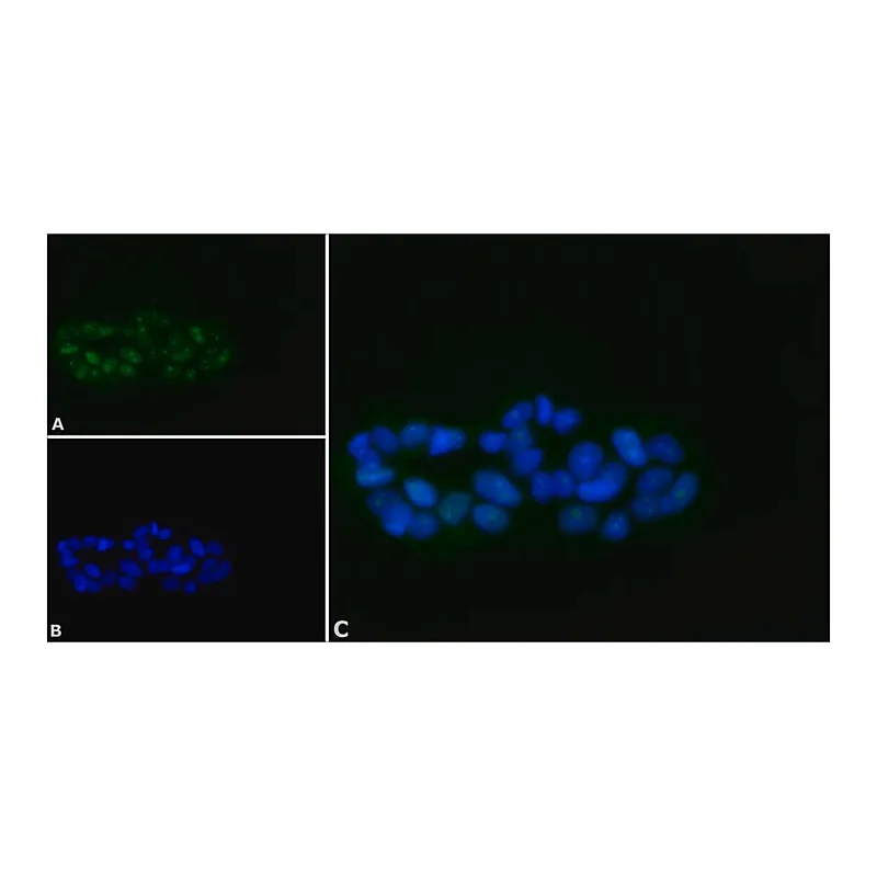 Merck Anti-BACH1 antibody produced in rabbit