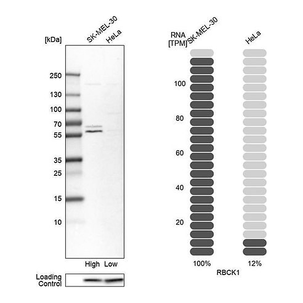 Merck Anti-RBCK1 antibody produced in rabbit