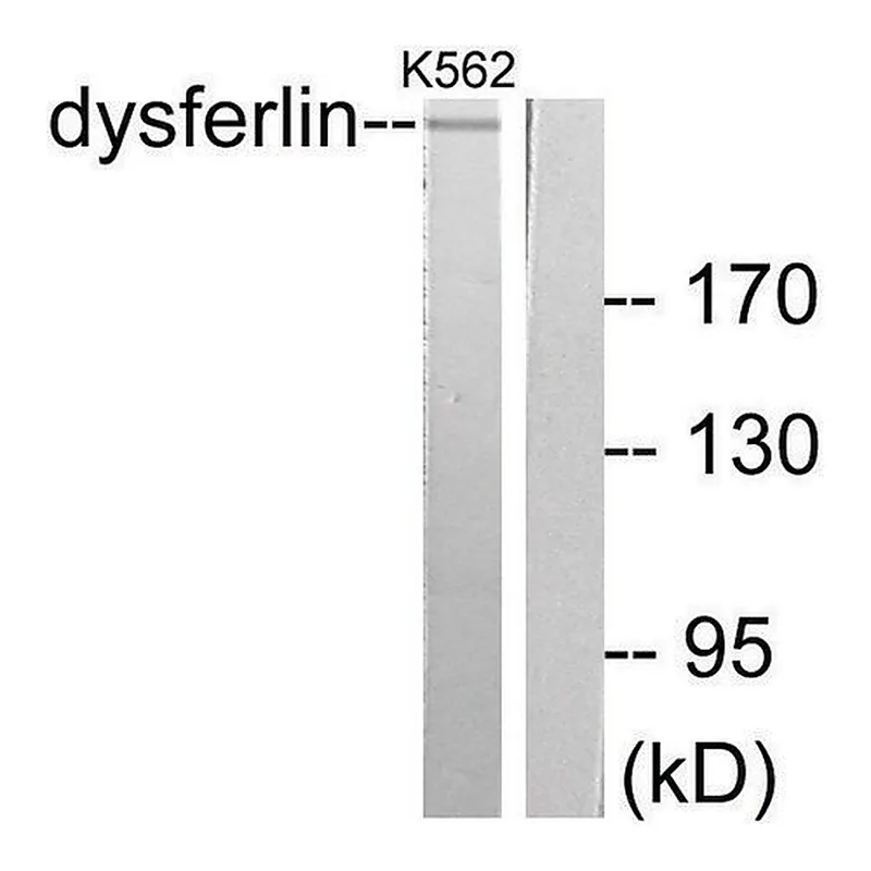 Merck Anti-Dysferlin, antibody produced in rabbit