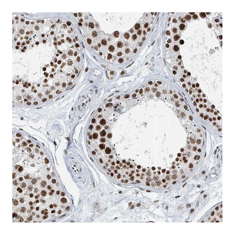 Atlas Antibodies Anti-FIP1L1 Antibody