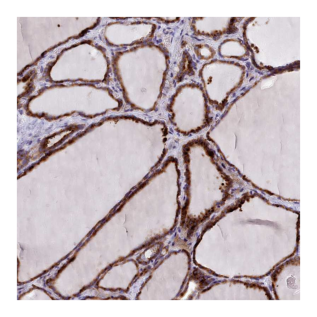 Atlas Antibodies Anti-FKBP10 Antibody