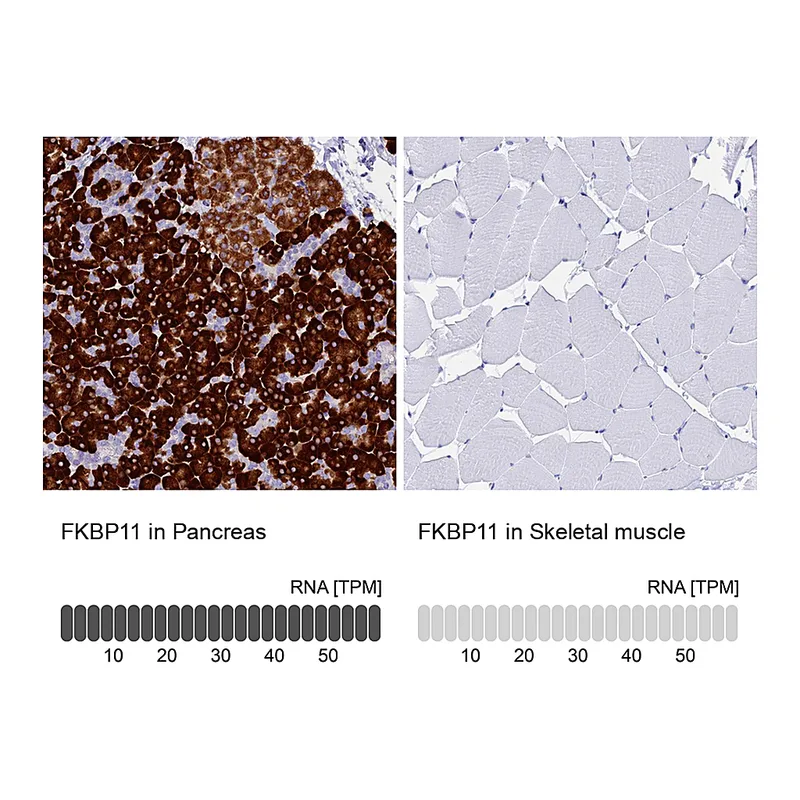 Atlas Antibodies Anti-FKBP11 Antibody