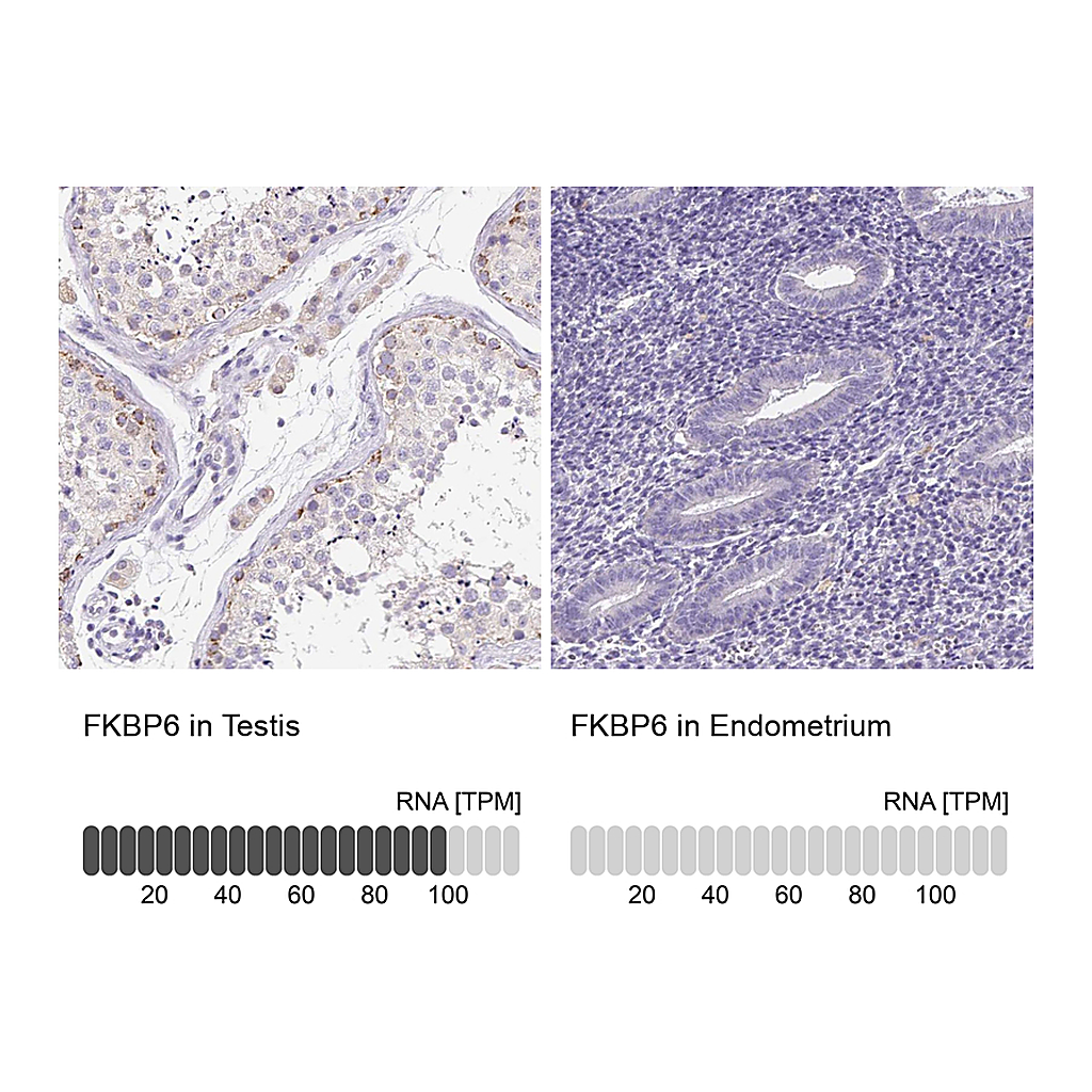 Atlas Antibodies Anti-FKBP6 Antibody