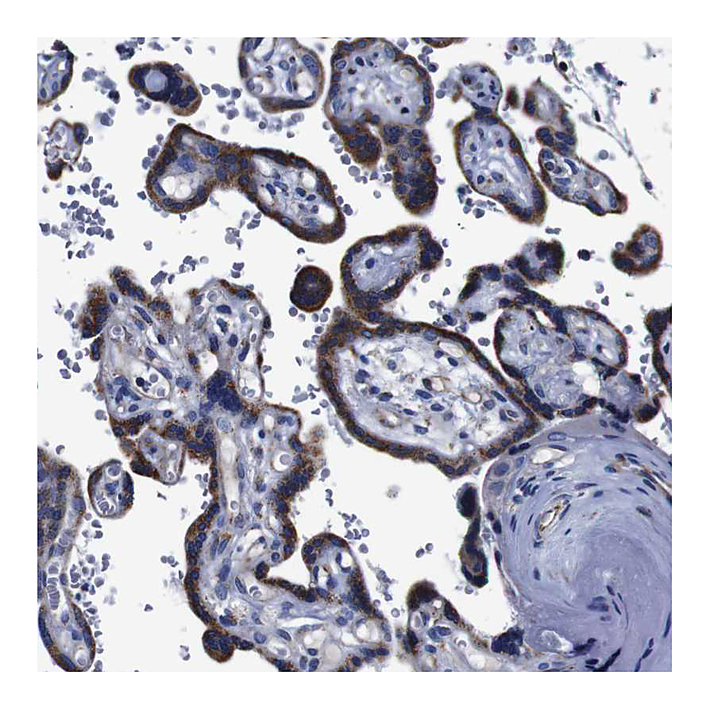 Atlas Antibodies Anti-FKBP9 Antibody