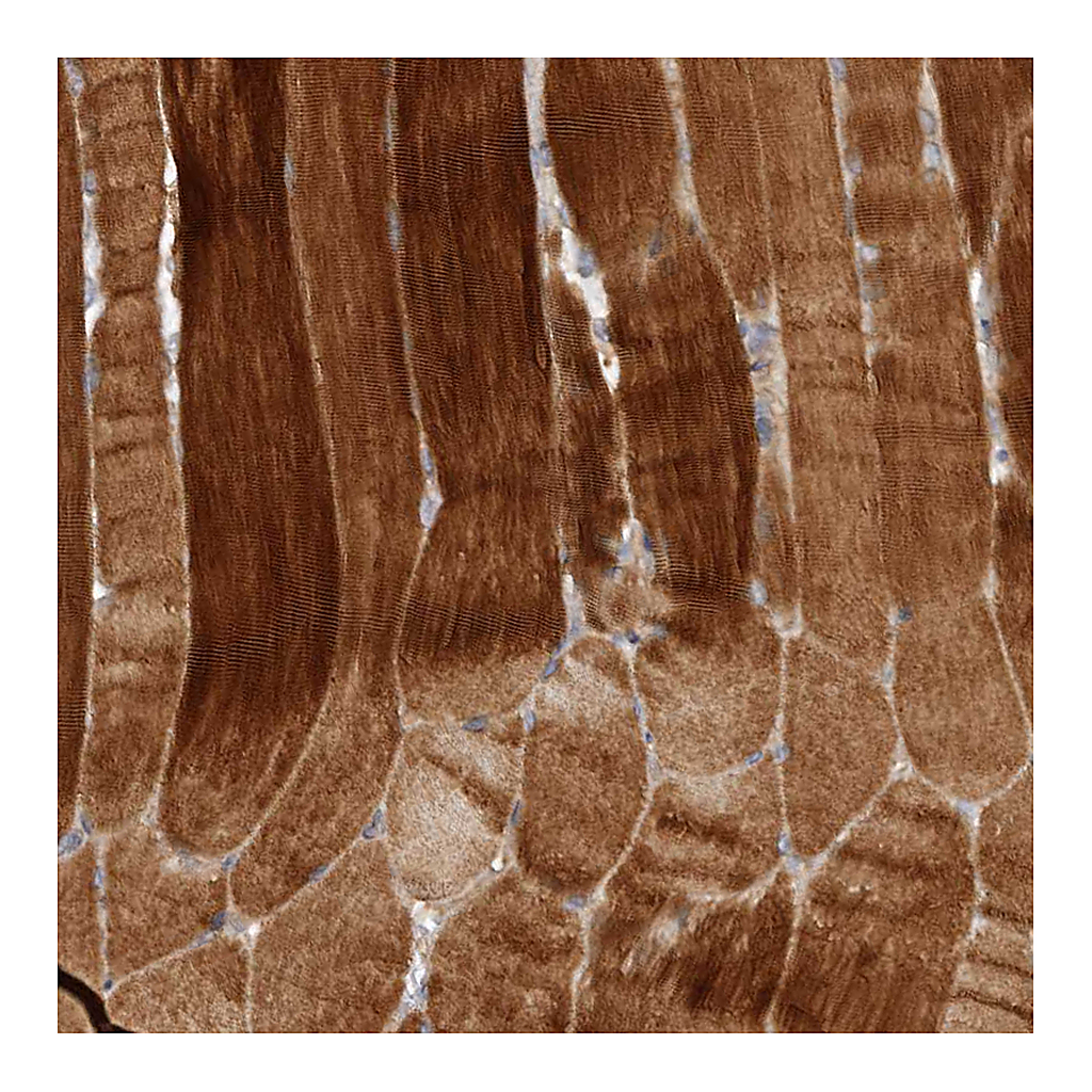Atlas Antibodies Anti-FLCN Antibody