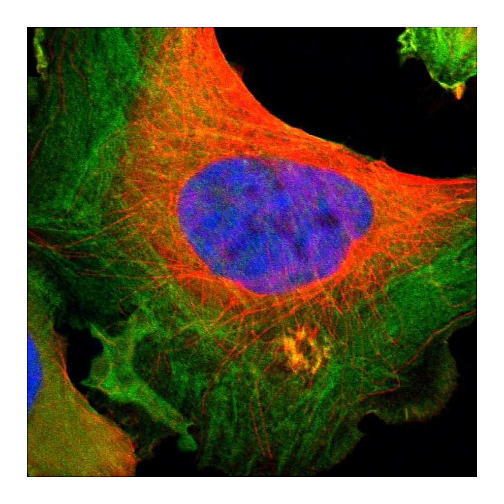 Atlas Antibodies Anti-FLNA Antibody