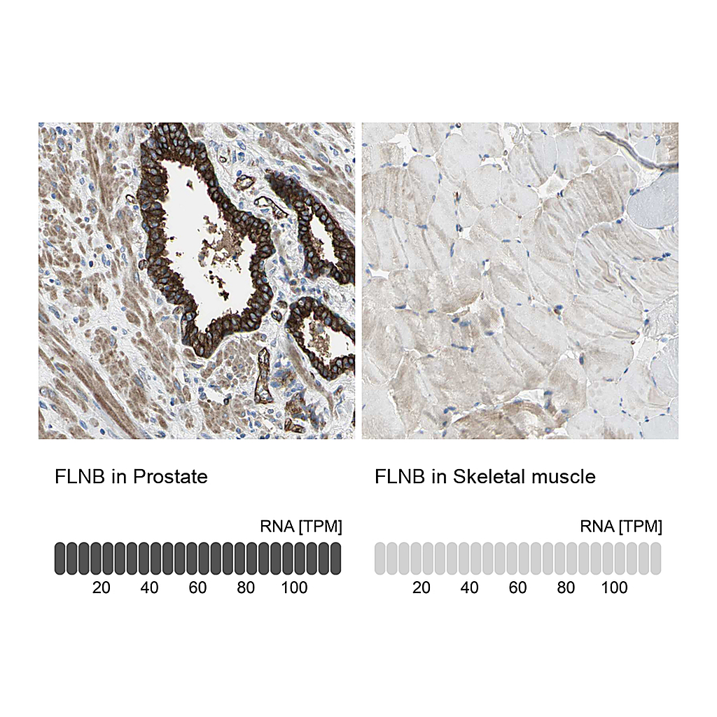Atlas Antibodies Anti-FLNB Antibody