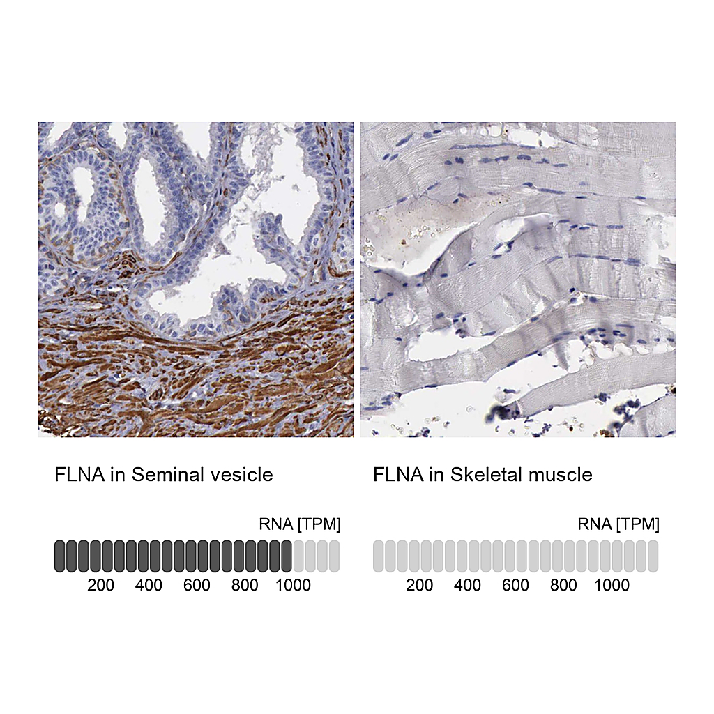 Atlas Antibodies Anti-FLNA Antibody