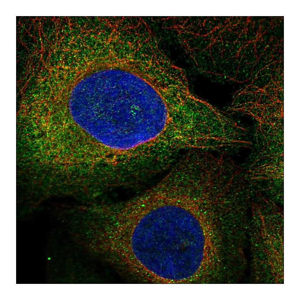 Atlas Antibodies Anti-FLT3 Antibody