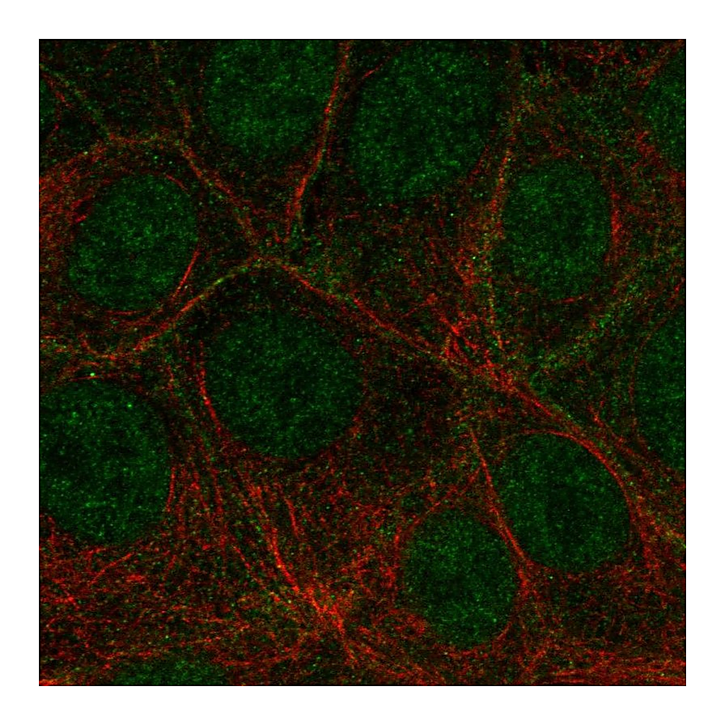 Atlas Antibodies Anti-FLT4 Antibody