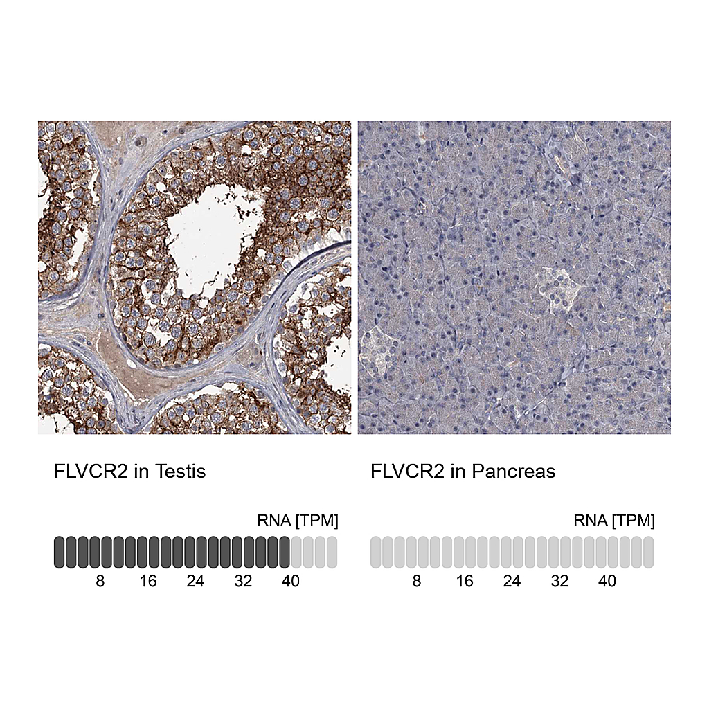 Atlas Antibodies Anti-FLVCR2 Antibody