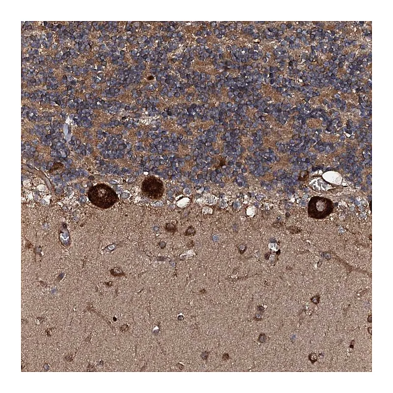Atlas Antibodies Anti-FLYWCH1 Antibody
