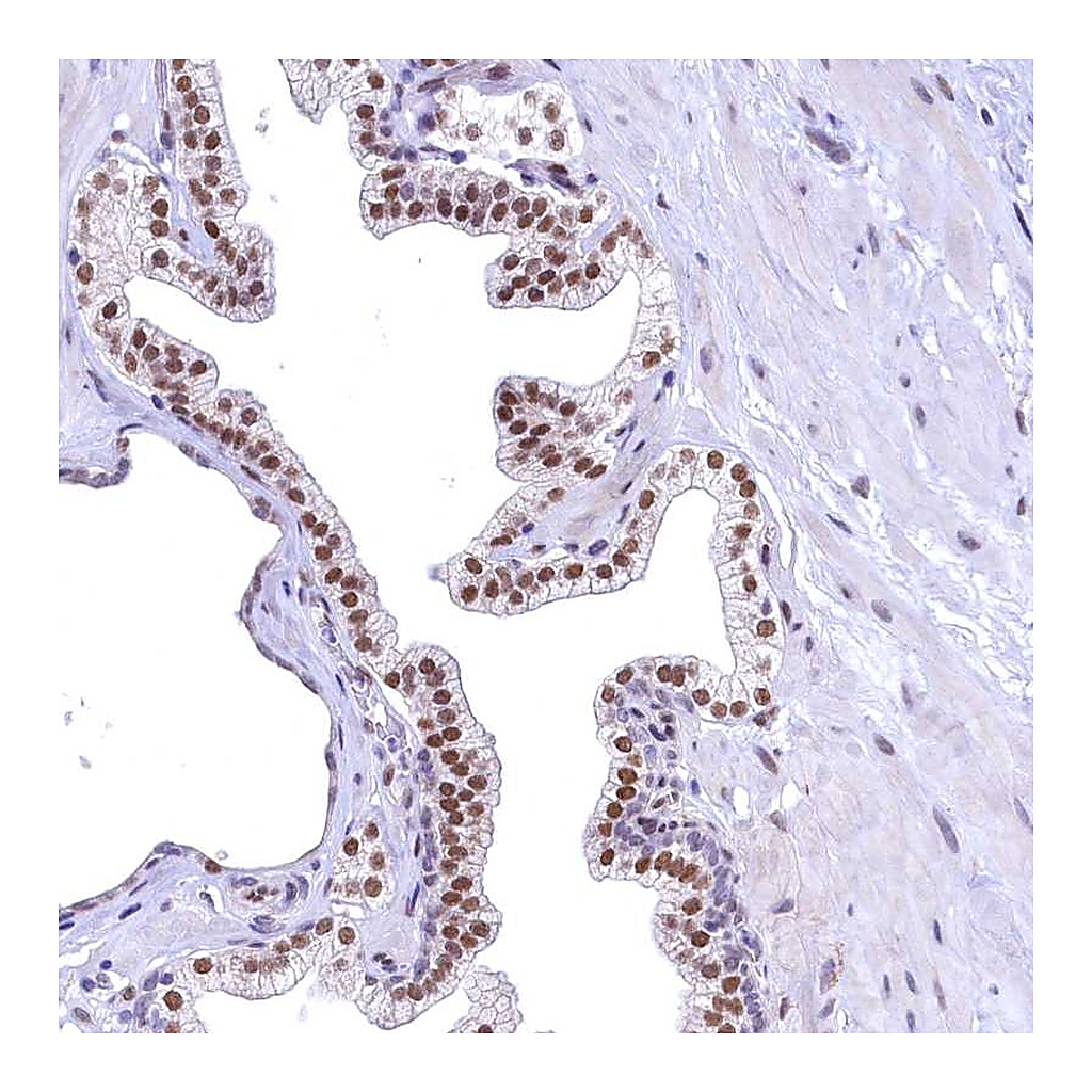 Atlas Antibodies Anti-FLYWCH2 Antibody