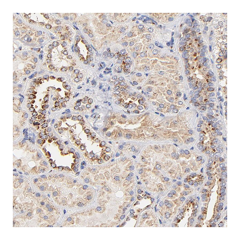 Atlas Antibodies Anti-FMNL3 Antibody