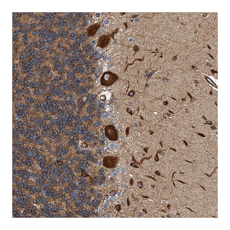 Atlas Antibodies Anti-FMNL3 Antibody