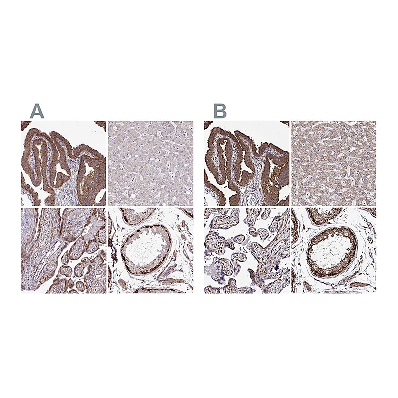 Atlas Antibodies Anti-FMR1 Antibody