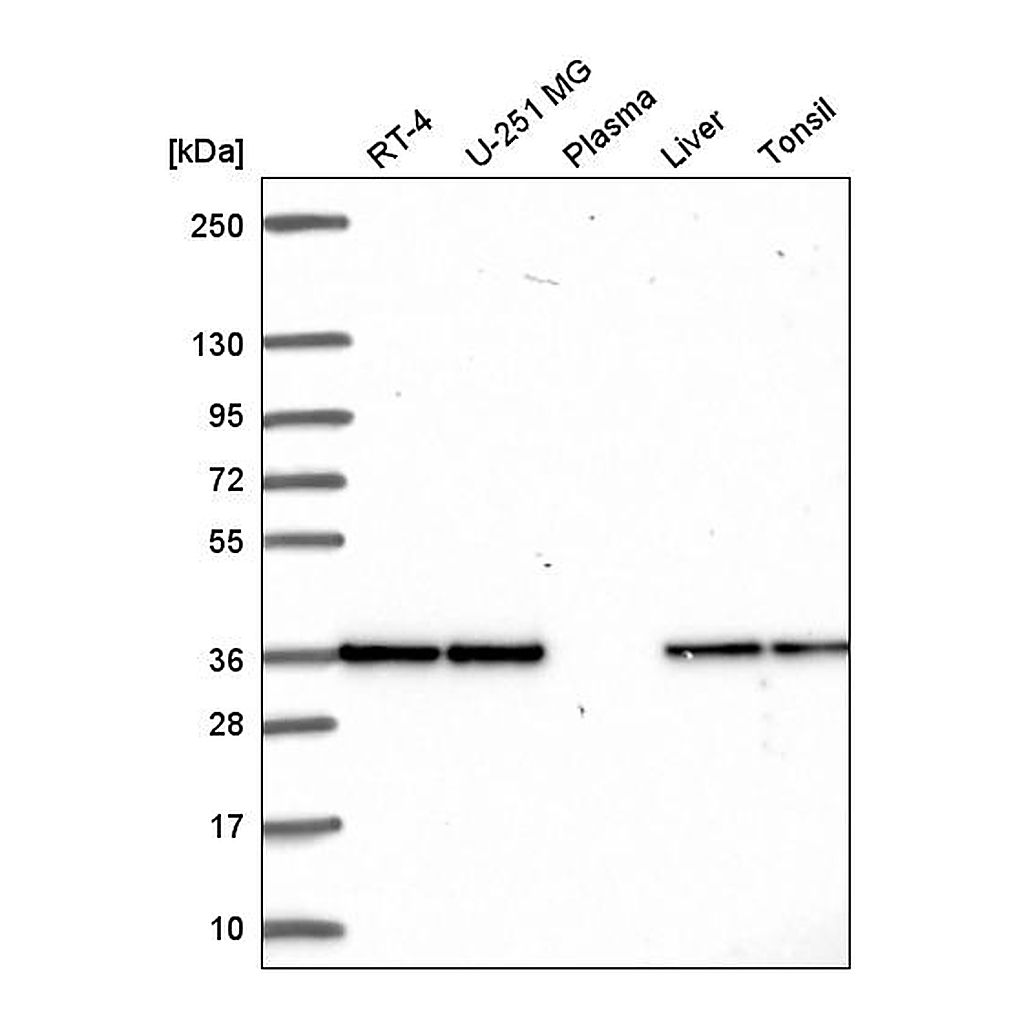 Atlas Antibodies Anti-FN3KRP Antibody